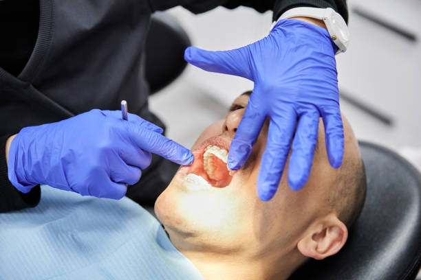 Best Emergency Dental Extractions in Mckinney, TX